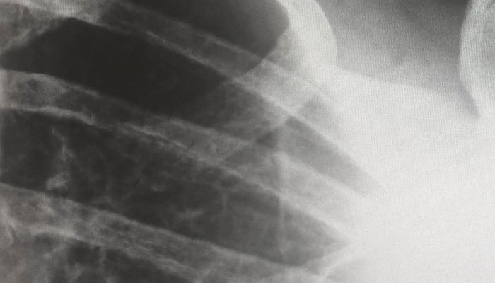 Digital Medical Imaging